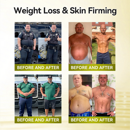 🐝 𝑵𝒆𝒘 𝑨𝒓𝒓𝒊𝒗𝒂𝒍𝒔｜Curalona® Bee Venom Slimming Patch · Berberine · Astaxanthin Detox Formula   （Visible Body Contour • Water Retention Relief • Cellulite Smoothing • Metabolic Activation ） 7-Day Lymphatic Detox & Fat-Burn Program
